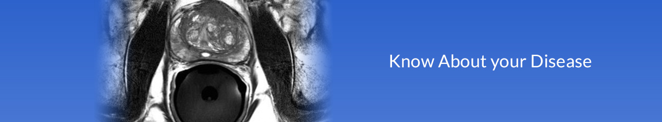 Prostate Treatment in Navi Mumbai